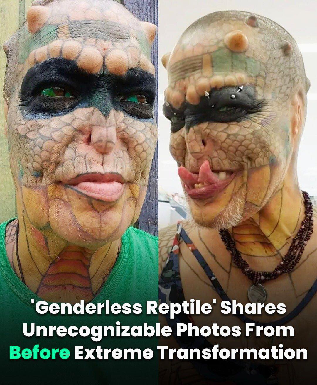 Unrecognizable Images From Before Extreme Transformation Shared By A “Genderless Reptile”